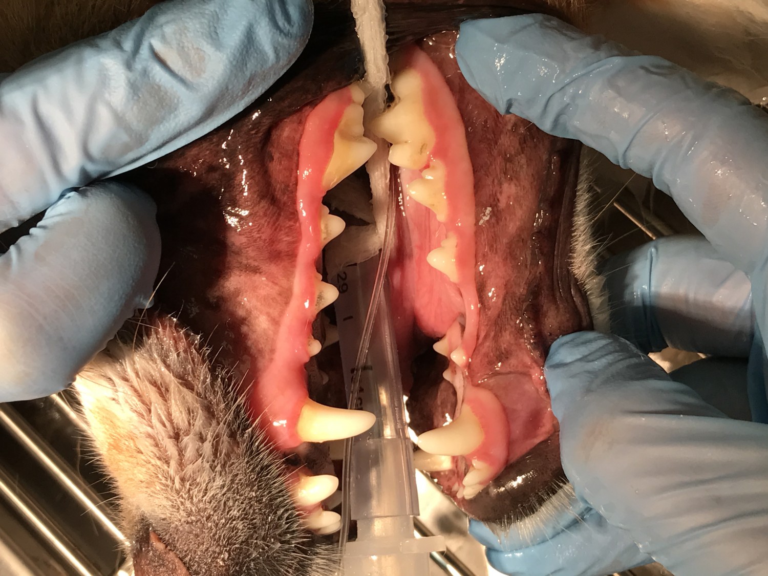 Periodontal Disease and Gingivitis Before Dental Treatment  - even though there is not much tartar on these teeth the gum  is red and inflammed at the tooth with most tartar. Gingivitis is present.